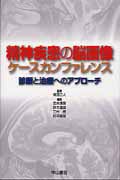精神疾患の脳画像 ケースカンファレンス 診断と治療へのアプローチ