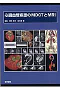 心臓血管疾患のMDCTとMRI