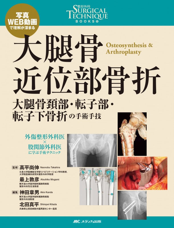 大腿骨近位部骨折 大腿骨頚部・転子部・転子下骨折の手術手技 | 北田