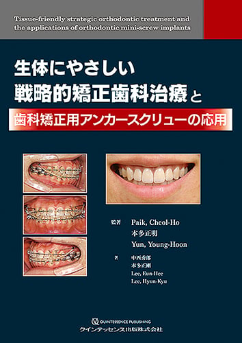 見る目が変わる! 「欠損歯列」の読み方,「欠損補綴」の設計 | 本多正明