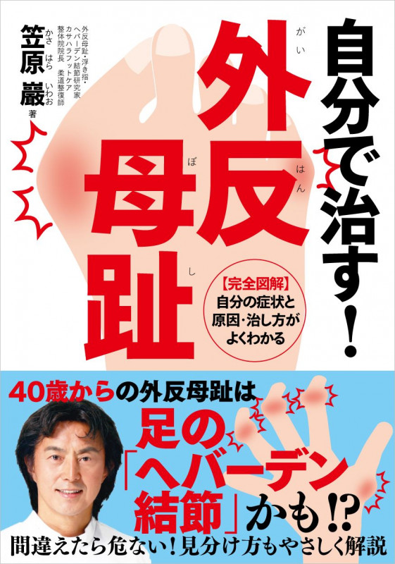 自分で治す!外反母趾