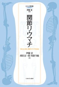 関節リウマチ 「流れる」病気、関節リウマチを知る (シリーズ・骨の話 2)