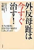 外反母趾は今すぐ治す! 本当の原因と自分で治す秘訣は「これ」だった!