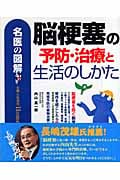 名医の図解 脳梗塞の予防・治療と生活のしかた