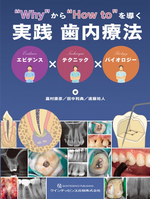“Why”から“How to”を導く実践 歯内療法 エビデンス×テクニック×バイオロジー