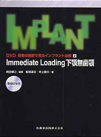 2 Immediate loading下顎無歯顎