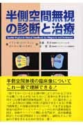 半側空間無視の診断と治療