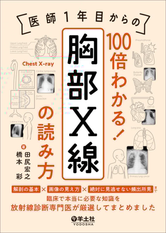 医師1年目からの 100倍わかる! 胸部X線の読み方