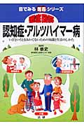 徹底図解 認知症・アルツハイマー病 いざというときあわてないための知識と生活のしかた