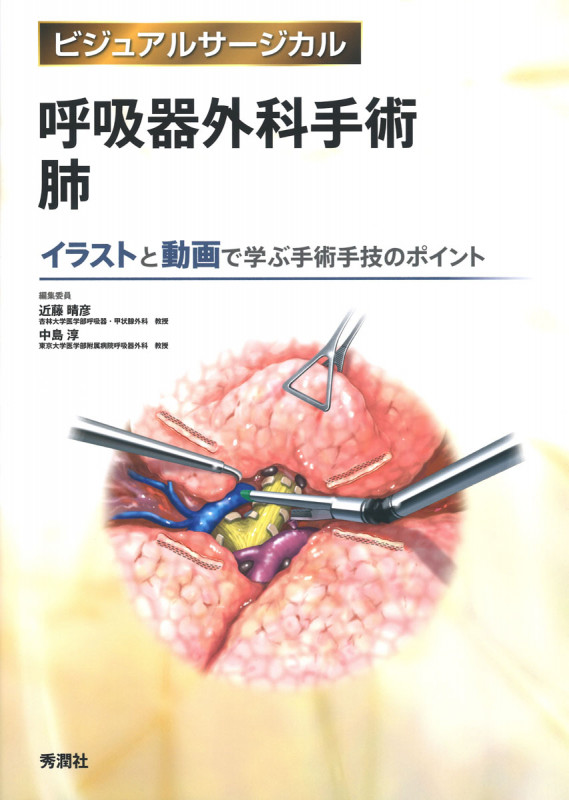 呼吸器外科手術 肺 イラストと動画で学ぶ手術手技のポイント (ビジュアルサージカル)