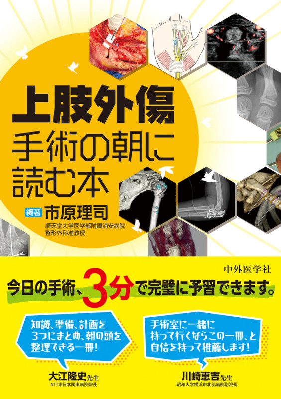 上肢外傷 手術の朝に読む本