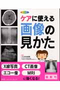 ケアに使える画像の見かた X線写真・CT画像・エコー像・MRI