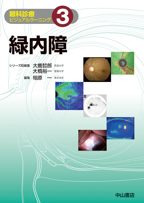 緑内障 (眼科診療ビジュアルラーニング 3)