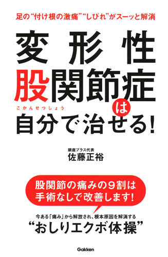 変形性股関節症は自分で治せる!の詳細を見る