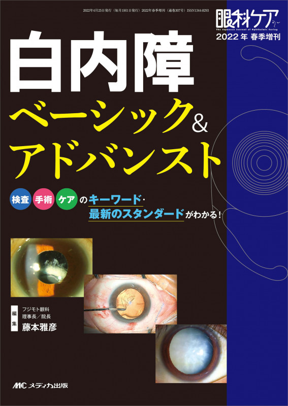白内障 ベーシック&アドバンスト 検査・手術・ケアのキーワード・最新のスタンダードがわかる! (眼科ケア2022年春季増刊)