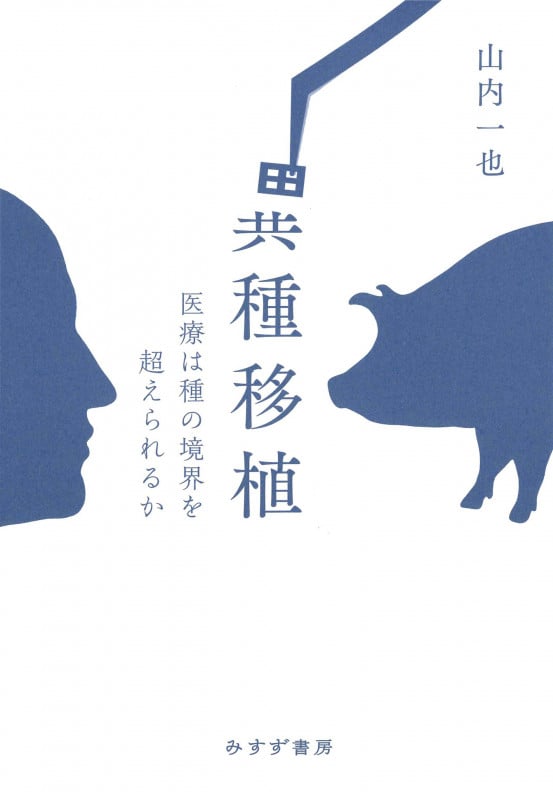 異種移植 医療は種の境界を超えられるか