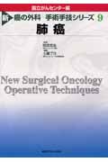 肺癌 (新 癌の外科)