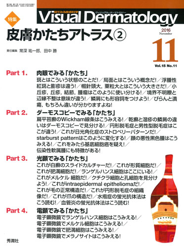 ヴィジュアル・ダーマトロジー(Visual Dermatology) 特集 皮膚かたちアトラス 2 (Vol.15 No.11)