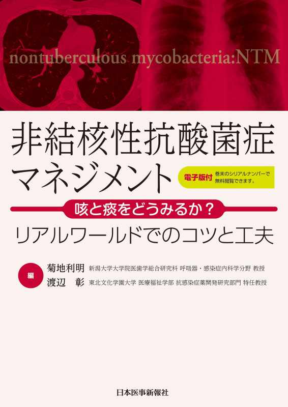 非結核性抗酸菌症マネジメント 咳と痰をどうみるか? リアルワールドでのコツと工夫