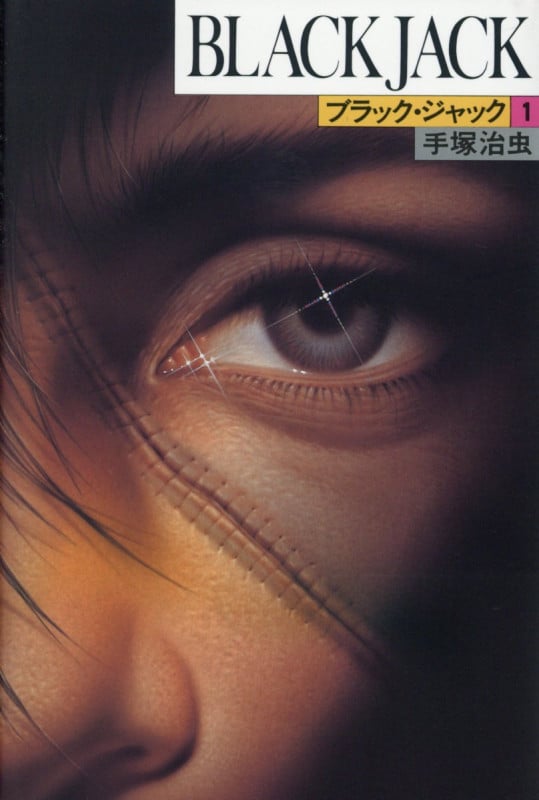 BLACK JACK(ブラック・ジャック)1