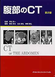 腹部のCT
