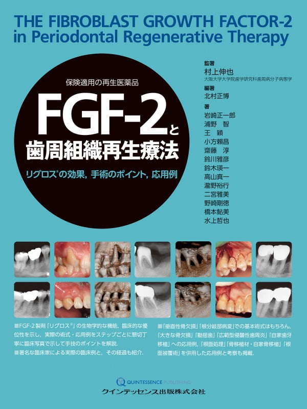 FGF-2と歯周組織再生療法 リグロスの効果,手術のポイント,応用例