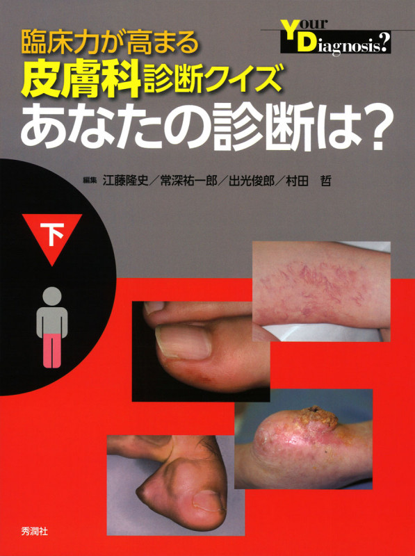 臨床力が高まる皮膚科診断クイズ あなたの診断は? (下)