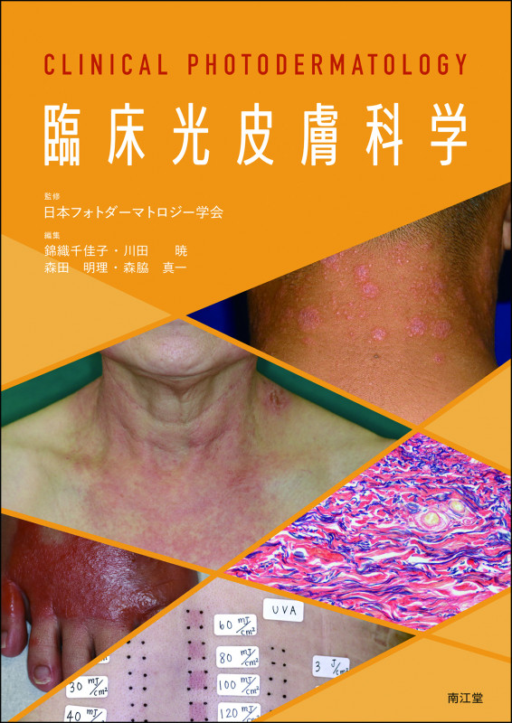 臨床光皮膚科学