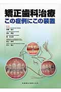 矯正歯科治療 この症例にこの装置