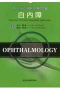 白内障 (すぐに役立つ眼科診療の知識)