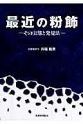 最近の粉飾 その実態と発見法