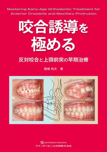咬合誘導を極める 反対咬合と上顎前突の早期治療 | 関崎和夫のあらすじ