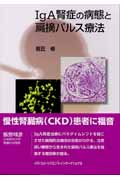 IgA腎症の病態と扁摘パルス療法