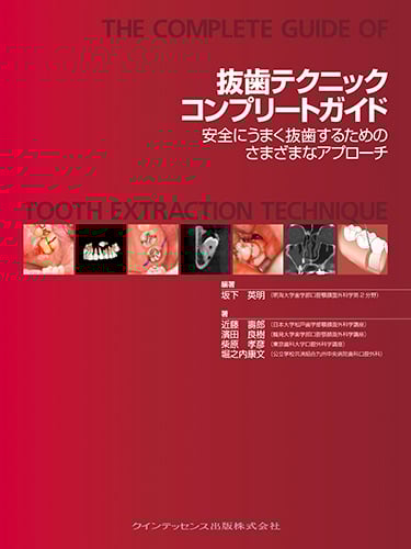 抜歯手術 上 基礎知識と基本手技・難抜歯・上顎埋伏歯等抜歯 | 公益