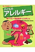 知っておきたい子どものアレルギー (1)