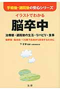 イラストでわかる脳卒中 治療後・退院後の生活・リハビリ・食事 (手術後・退院後の安心シリーズ)