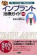 わかり易いインプラント治療ガイド 「第二の永久歯」で噛む喜びを!