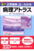 正常画像と比べてわかる 病理アトラス