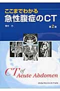 ここまでわかる 急性腹症のCT 第2版