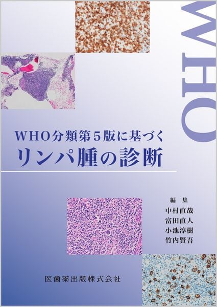 WHO分類第5版に基づくリンパ腫の診断