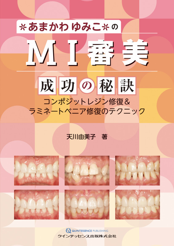 臼歯部コンポジットレジン修復 MI時代の臨床戦略 | 天川由美子の 臼歯部コンポジットレジン修復 MI時代の臨床戦略 | 天川由美子の