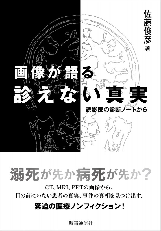 画像が語る診えない真実 読影医の診断ノートから
