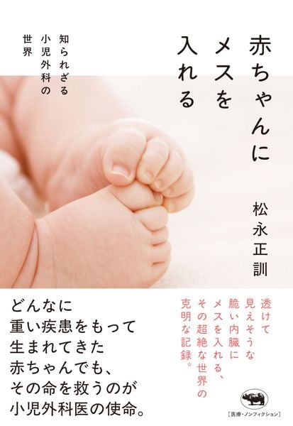赤ちゃんにメスを入れる 知られざる小児外科の世界