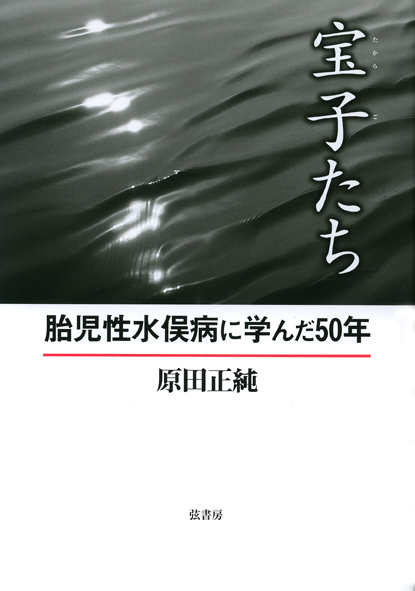 宝子たち 胎児性水俣病に学んだ50年