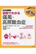 図解でわかる痛風・高尿酸血症 (徹底対策シリーズ)