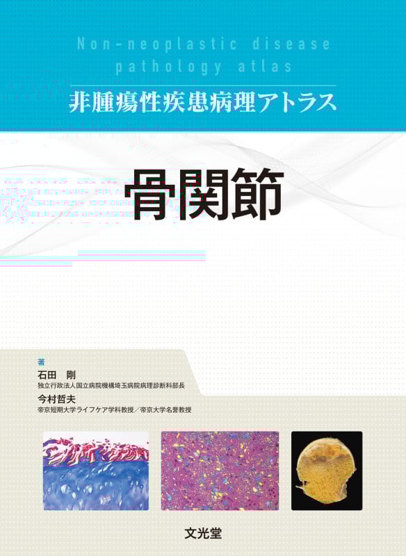 骨関節(非腫瘍性疾患病理アトラス) (非腫瘍性疾患病理アトラス)