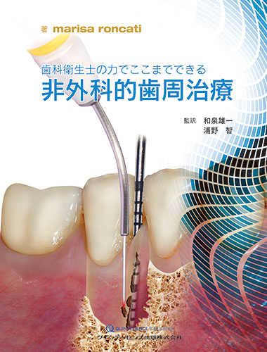 垂直的および水平的歯槽堤増大術 ソーセージテクニックと新たなコンビネーショング… Amazon.co.jp: 垂直的および水平的歯槽堤増大術: ソーセージ