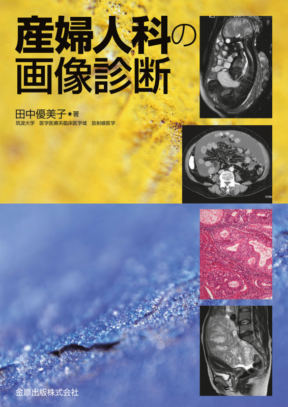 産婦人科の画像診断