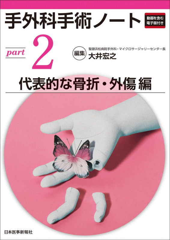 手外科手術ノート part2:代表的な骨折・外傷編