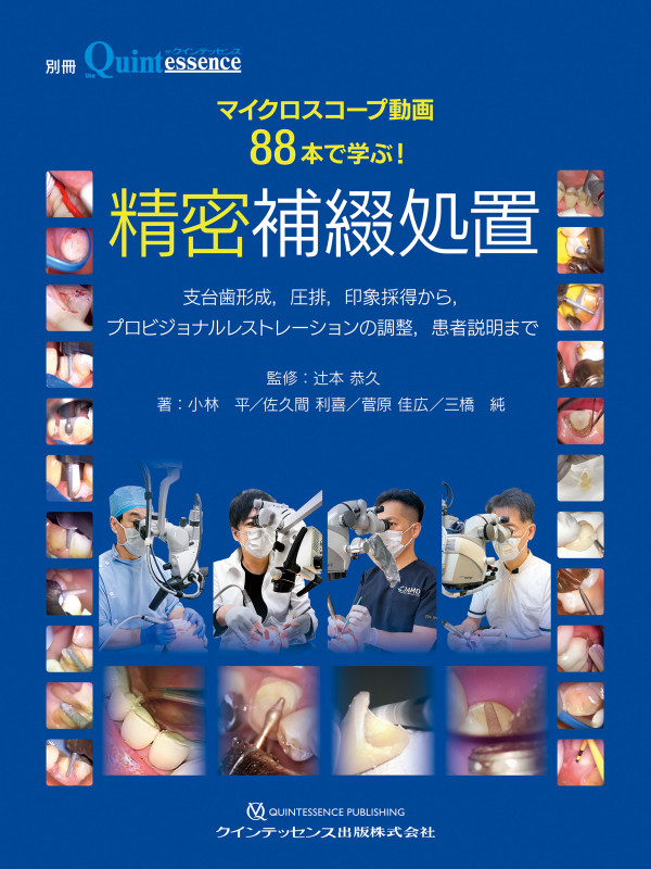 低侵襲・低コスト・省時間を実現する バシロジックエンドファイル